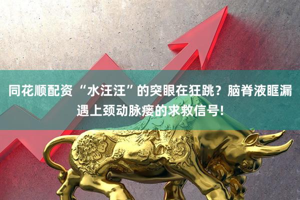 同花顺配资 “水汪汪”的突眼在狂跳？脑脊液眶漏遇上颈动脉瘘的求救信号!